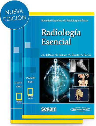 Imagen de SERAM Radiología Esencial, 2 Vols. (Incluye eBook)
