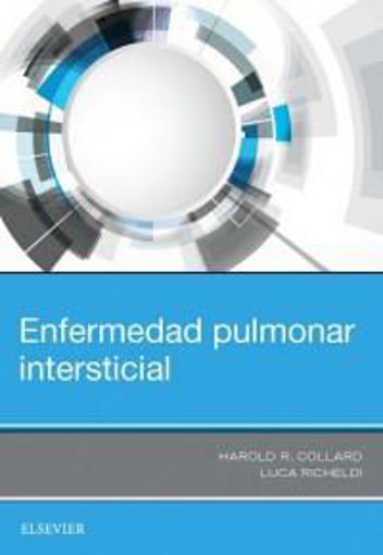 Imagen de ENFERMEDAD PULMONAR INTERSTICIAL