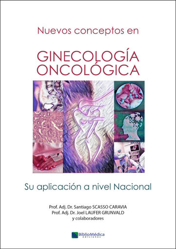 Imagen de Ginecología oncológica Nuevos conceptos