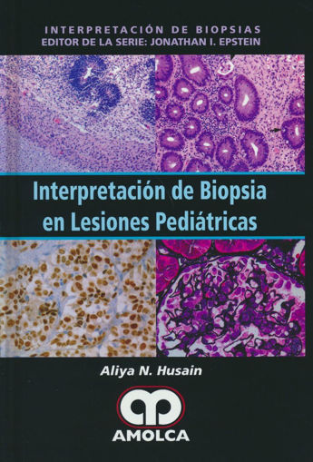 Imagen de Interpretación de biopsia en lesiones pediátricas