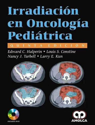Imagen de IRRADIACION EN ONCOLOGIA PEDIATRICA