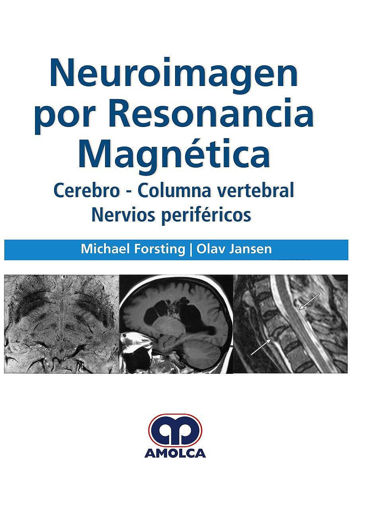 Imagen de NEUROIMAGEN POR RESONANCIA MAGNETICA