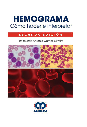 Imagen de Hemograma. Cómo Hacer e Interpretar