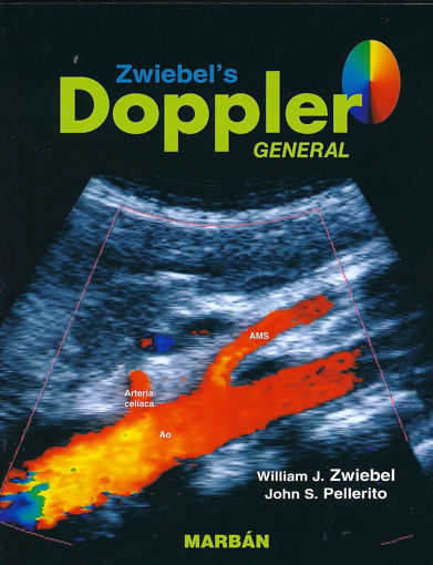 Imagen de Doppler General Handbook