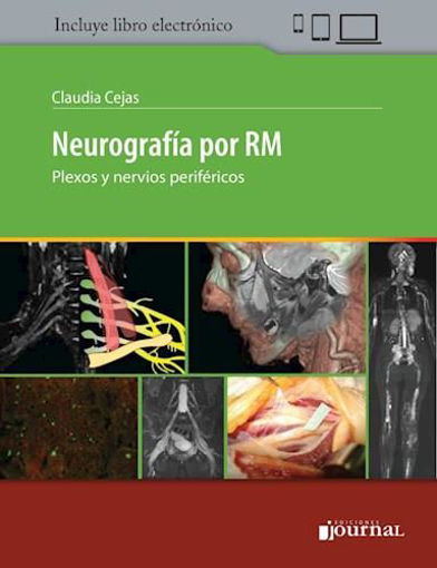 Imagen de NEUROGRAFÍA POR RM