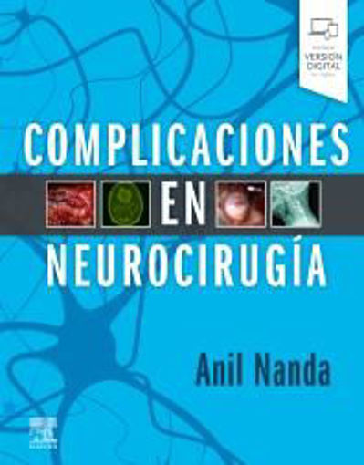 Imagen de COMPLICACIONES EN NEUROCIRUGÍA