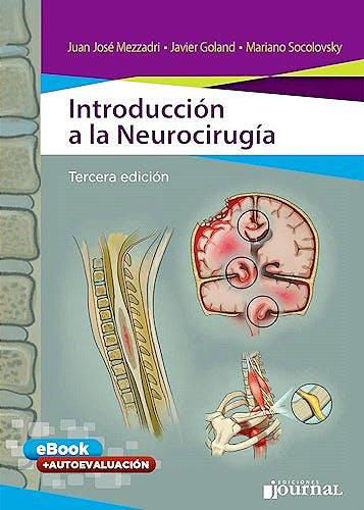 Imagen de Introducción a la Neurocirugía (Libro + E-Book con Autoevaluación)