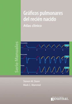 Imagen de GRAFICOS PULMONARES DEL RECIEN NACIDO