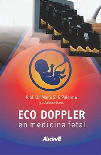 Imagen de Eco Doppler en Medicina Fetal