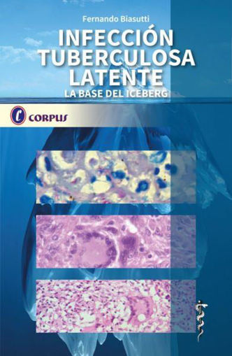 Imagen de Infección tuberculosa latente La base del iceberg