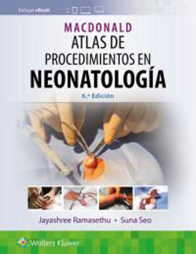 e book MacDonald Atlas de procedimientos en neonatologia