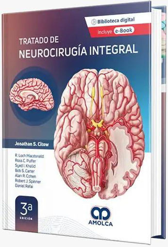 Imagen de Tratado de neurocirugia integral