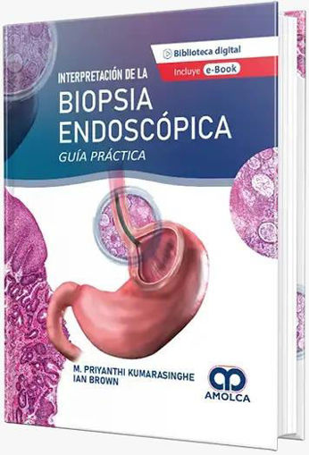 Imagen de Interpretacion de la Biopsia Endoscopica - Guia práctica