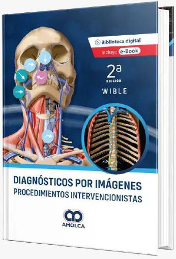Imagen de Diagnosticos por imagenes - Procedimientos Intervencionistas