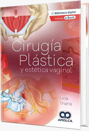 Imagen de Cirugia plastica y estetica vaginal