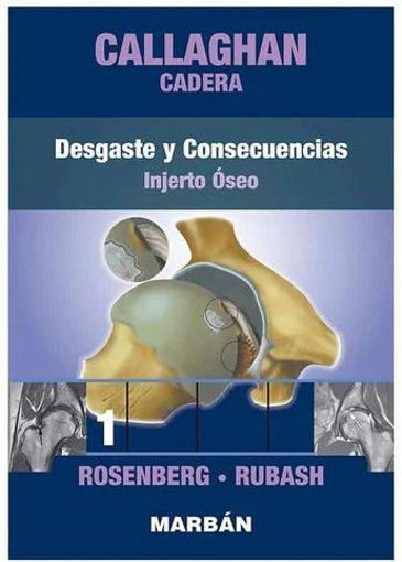 Imagen de Callaghan Cadera Vol. 1 Desgaste y Consecuencias. Injerto Óseo