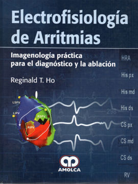 Imagen de Electrofisiología de Arritmias
