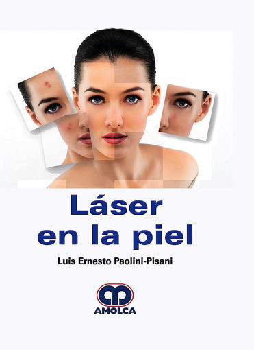 Imagen de LASER EN LA PIEL