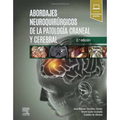 Imagen de Abordajes neuroquirúrgicos de la patología craneal y cerebral