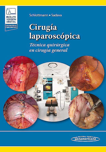 Imagen de Cirugía laparoscópica Técnicas quirúrgicas en cirugía general