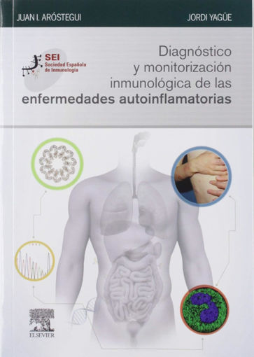 Imagen de Diagnóstico y monitorización inmunológica de las enfermedades autoinflamatorias