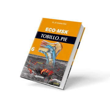 Imagen de ECO MSK Tobillo y Pie.