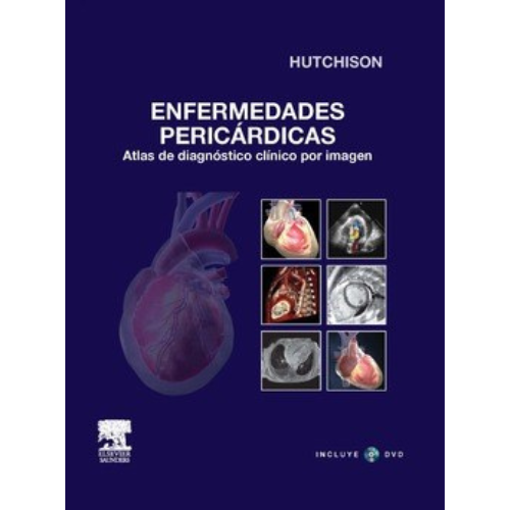 Imagen de Enfermedades Pericárdicas.Atlas de diagnóstico clínico por imagen