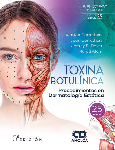 Imagen de TOXINA BOTULINICA. PROCEDIMIENTOS EN DERMATOLOGIA ESTETICA