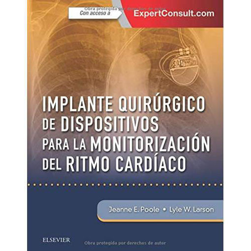 Imagen de Implante quirúrgico de dispositivos para la monitorización del ritmo cardíaco