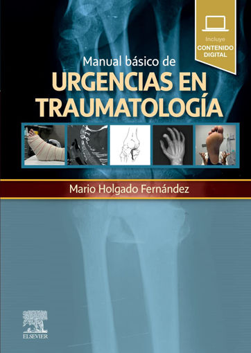 Imagen de MANUAL BASICO DE URGENCIAS EN TRAUMATOLOGIA + CONTENIDO DIGITAL