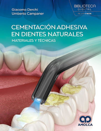 Imagen de CEMENTACION ADHESIVA EN DIENTES NATURALES. MATERIALES Y TECNICAS