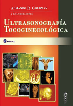 Imagen de Ultrasonografía Tocoginecólogica