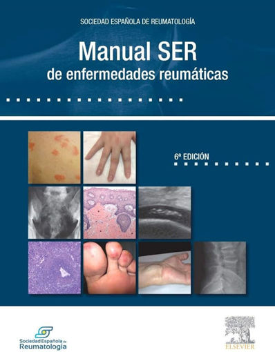 Imagen de Manual SER de enfermedades reumáticas
