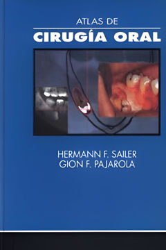 Imagen de Atlas de cirugía oral