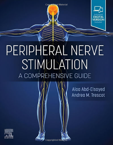 Imagen de Peripheral Nerve Stimulation