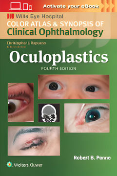 Imagen de Oculoplastics