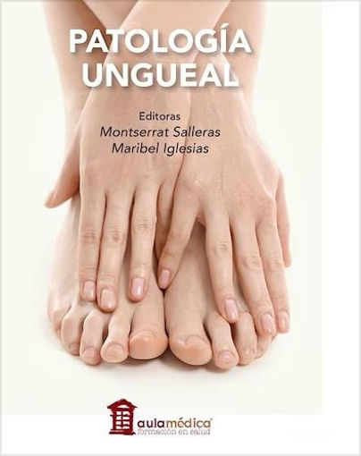 Imagen de PATOLOGIA UNGUEAL.