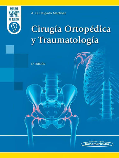 Imagen de Cirugia Ortopedica y Traumatologia