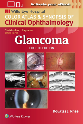 Imagen de Wills eye hospital Glaucoma