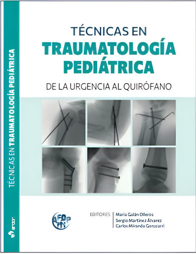 Imagen de Técnicas en traumatología pediátrica de la urgencia al quirófano