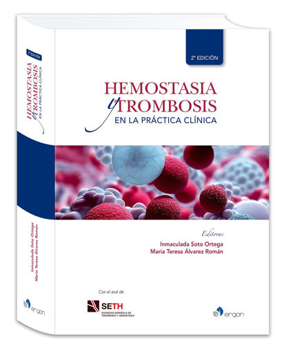Imagen de Hemostasia y trombosis en la práctica clínica