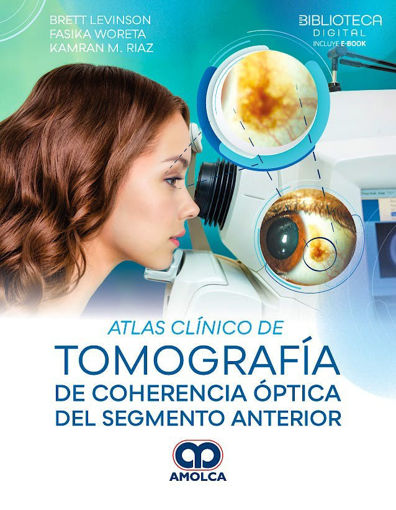 Imagen de Atlas clínico de Tomografía de coherencia óptica del Segmento Anterior