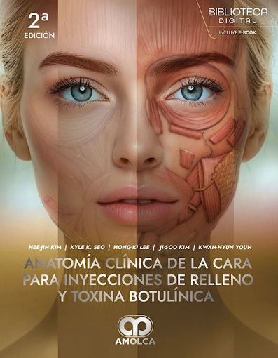 Imagen de Anatomía clínica de la cara para inyecciones de relleno y toxina botulínica.