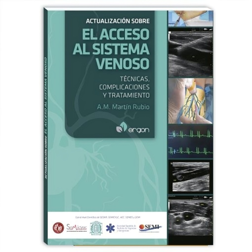 Imagen de Actualización sobre el Acceso al Sistema Venoso.