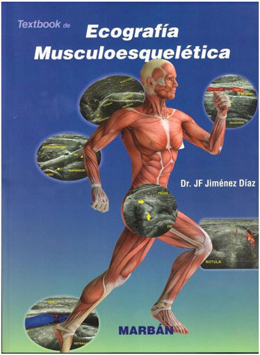 Imagen de Ecografía Musculoesquelética.