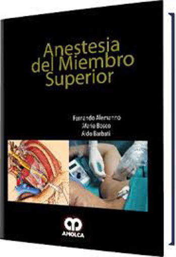 Imagen de Anestesia del Miembro Superior