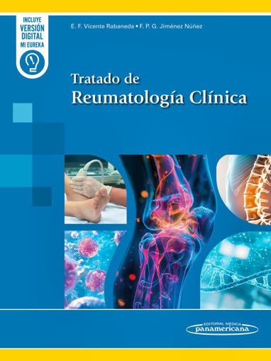 Imagen de Tratado de Reumatología Clínica