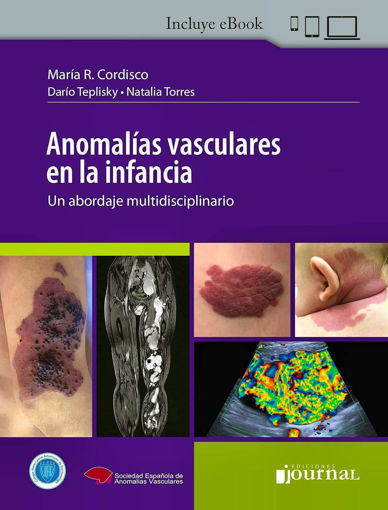 Imagen de Anomalías vasculares en la infancia