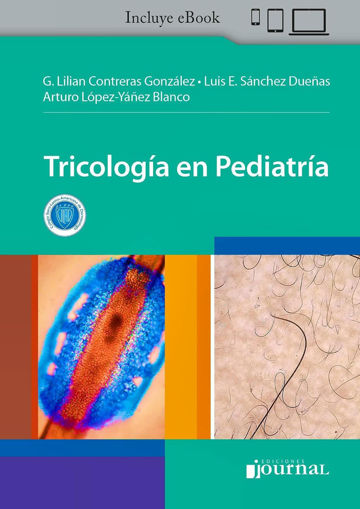 Imagen de Tricología en Pediatría