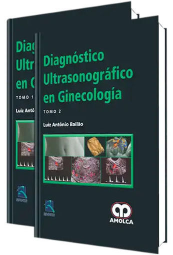 Imagen de Diagnóstico ultrasonográfico en ginecología 2 VOLS